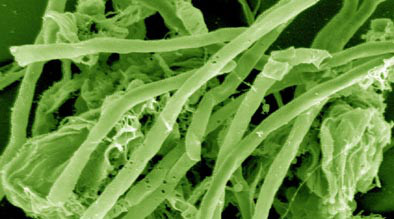 Archaea teaser